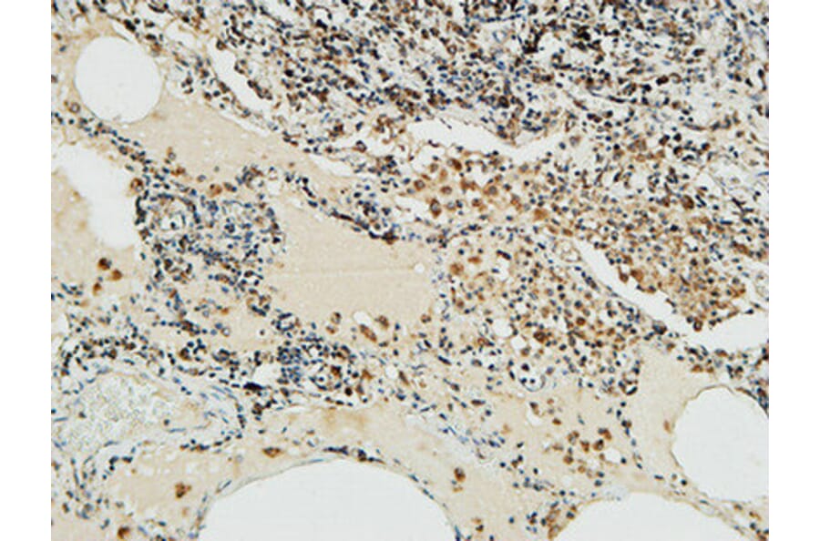 Immunohistochemistry - Anti-NBN Antibody (C13093) - Antibodies.com