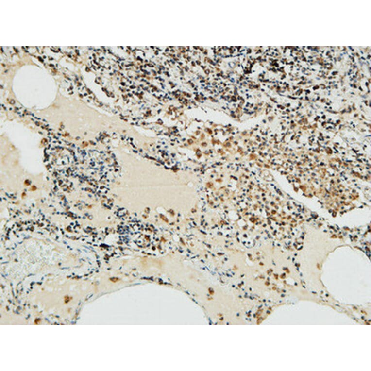 Immunohistochemistry - Anti-NBN Antibody (C13093) - Antibodies.com