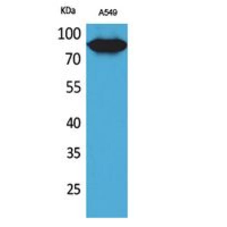 Western Blot - Anti-MME Antibody (C30016) - Antibodies.com