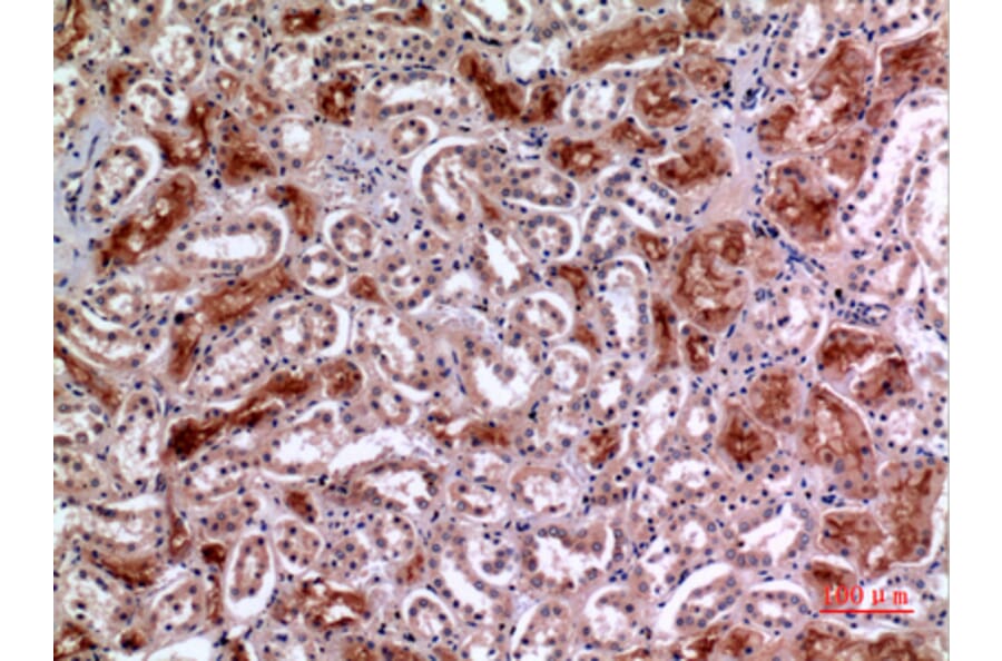 Immunohistochemistry - Anti-MME Antibody (C30016) - Antibodies.com