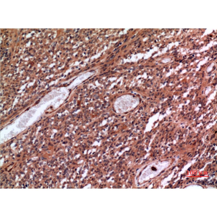 Immunohistochemistry - Anti-MME Antibody (C30016) - Antibodies.com