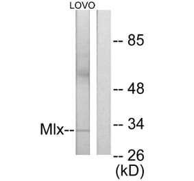 Western Blot - Anti-Mlx Antibody (C11841) - Antibodies.com
