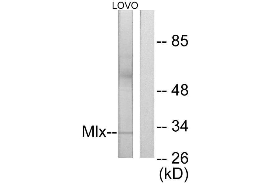 Western Blot - Anti-Mlx Antibody (C11841) - Antibodies.com