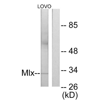 Western Blot - Anti-Mlx Antibody (C11841) - Antibodies.com