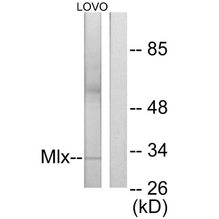 Western Blot - Anti-Mlx Antibody (C11841) - Antibodies.com