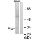 Western Blot - Anti-Mlx Antibody (C11841) - Antibodies.com