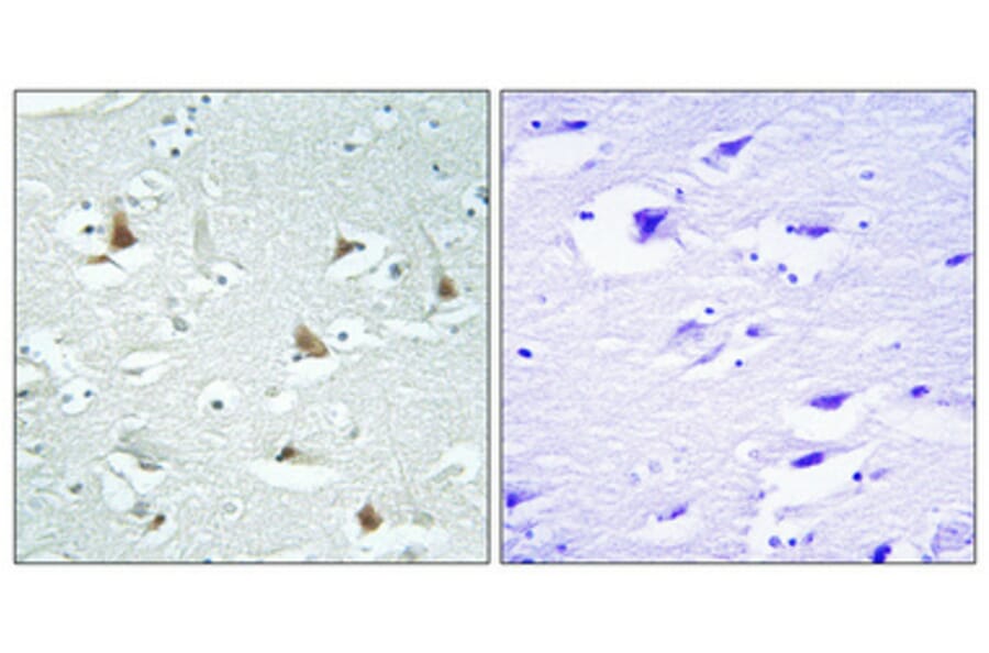 Immunohistochemistry - Anti-Mlx Antibody (C11841) - Antibodies.com