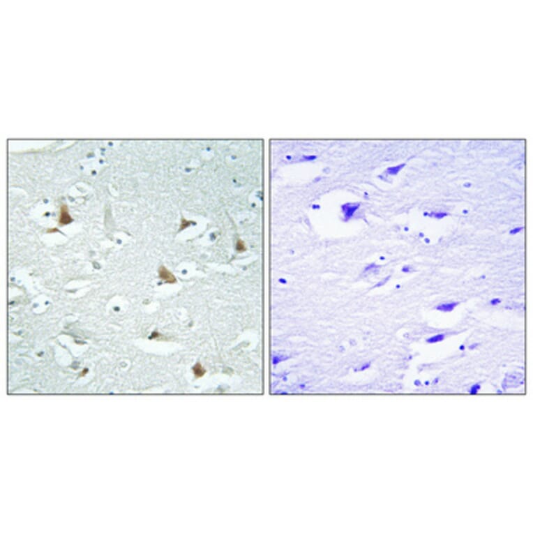 Immunohistochemistry - Anti-Mlx Antibody (C11841) - Antibodies.com
