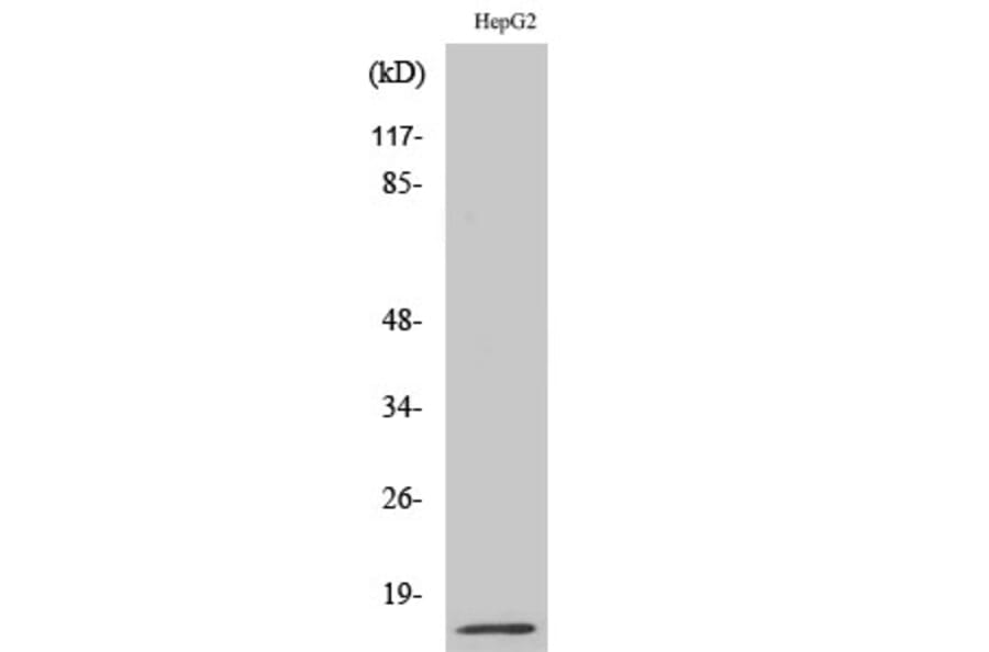 Western Blot - Anti-MIF Antibody (R12-2238) - Antibodies.com