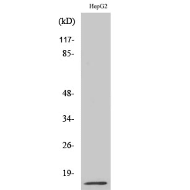 Western Blot - Anti-MIF Antibody (R12-2238) - Antibodies.com
