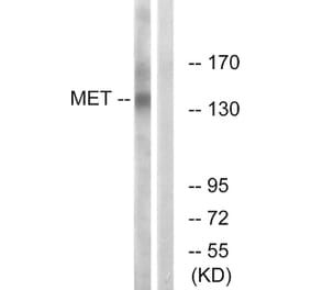 Western Blot - Anti-Met Antibody (B7152) - Antibodies.com