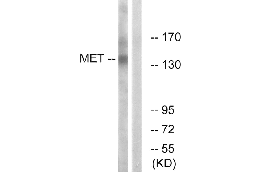 Western Blot - Anti-Met Antibody (B7152) - Antibodies.com