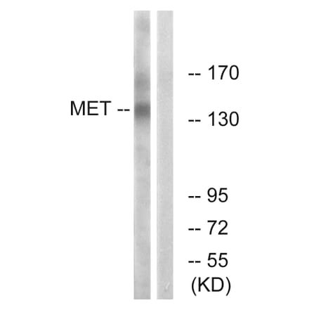 Western Blot - Anti-Met Antibody (B7152) - Antibodies.com