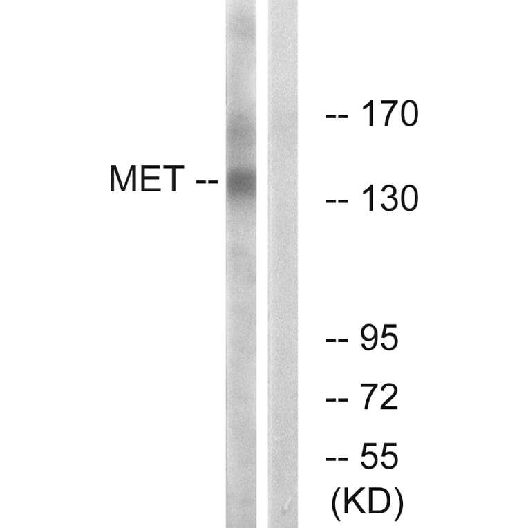 Western Blot - Anti-Met Antibody (B7152) - Antibodies.com