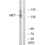 Western Blot - Anti-Met Antibody (B7152) - Antibodies.com