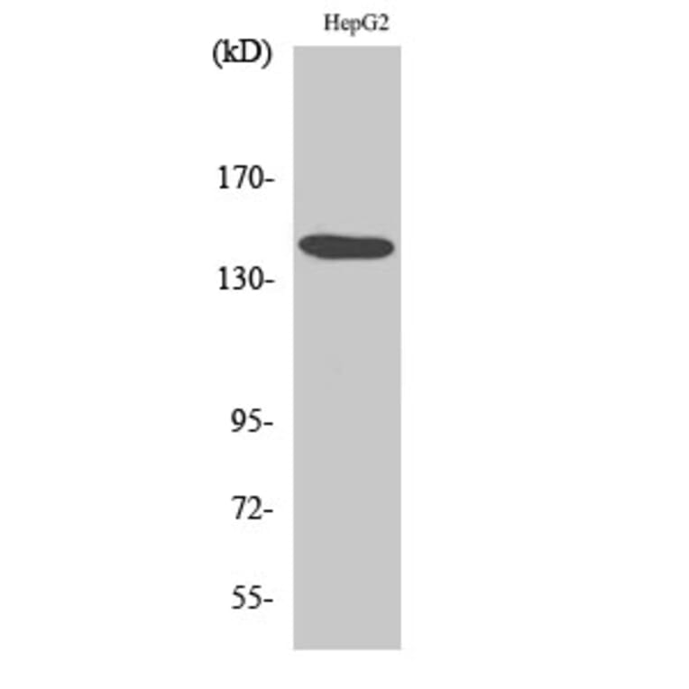 Western Blot - Anti-Met Antibody (B7152) - Antibodies.com
