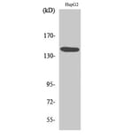 Western Blot - Anti-Met Antibody (B7152) - Antibodies.com