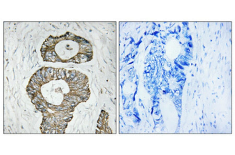 Immunohistochemistry - Anti-Met Antibody (B7152) - Antibodies.com