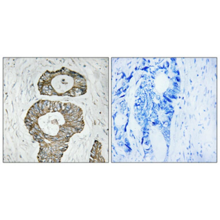 Immunohistochemistry - Anti-Met Antibody (B7152) - Antibodies.com