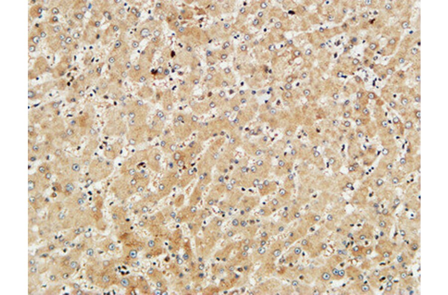 Immunohistochemistry - Anti-Met Antibody (B7152) - Antibodies.com