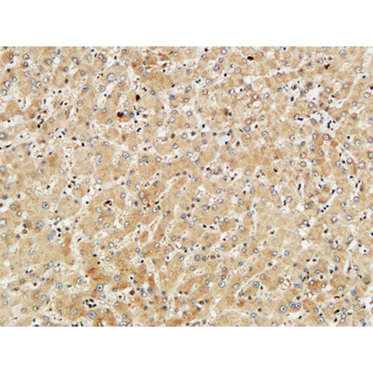 Immunohistochemistry - Anti-Met Antibody (B7152) - Antibodies.com