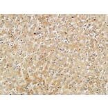 Immunohistochemistry - Anti-Met Antibody (B7152) - Antibodies.com