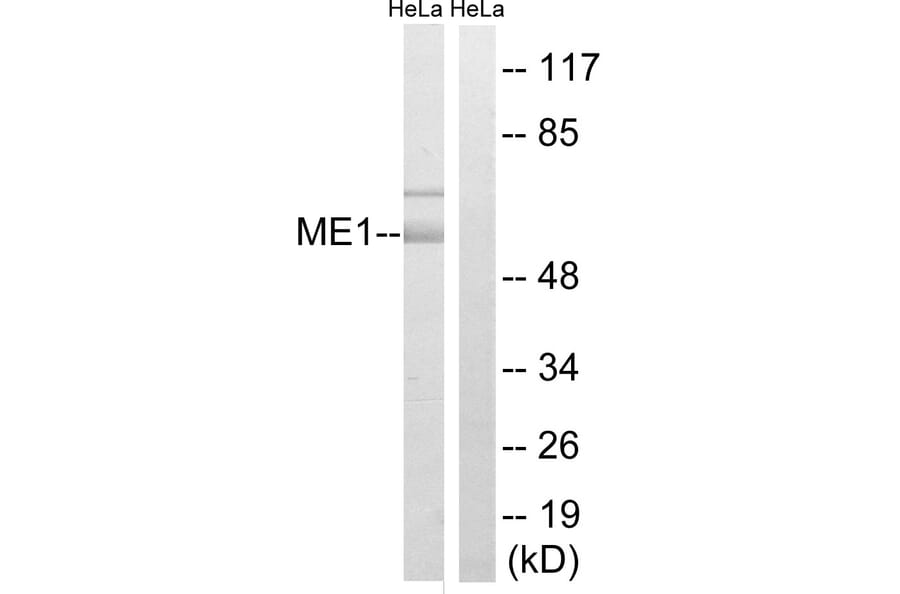 Western Blot - Anti-ME1 Antibody (C16863) - Antibodies.com