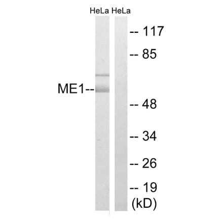 Western Blot - Anti-ME1 Antibody (C16863) - Antibodies.com