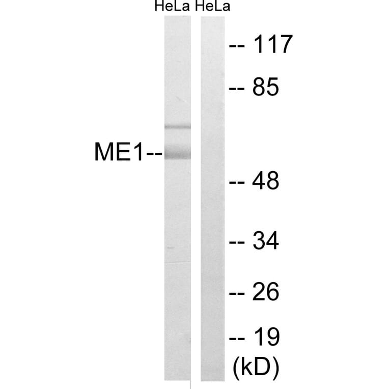 Western Blot - Anti-ME1 Antibody (C16863) - Antibodies.com