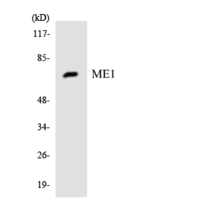 Western Blot - Anti-ME1 Antibody (R12-3011) - Antibodies.com