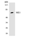 Western Blot - Anti-ME1 Antibody (R12-3011) - Antibodies.com