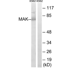 Western Blot - Anti-MAK Antibody (B8128) - Antibodies.com