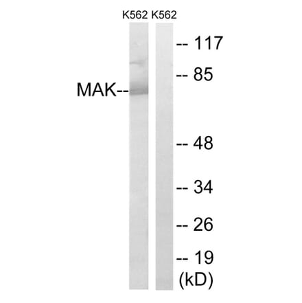 Western Blot - Anti-MAK Antibody (B8128) - Antibodies.com