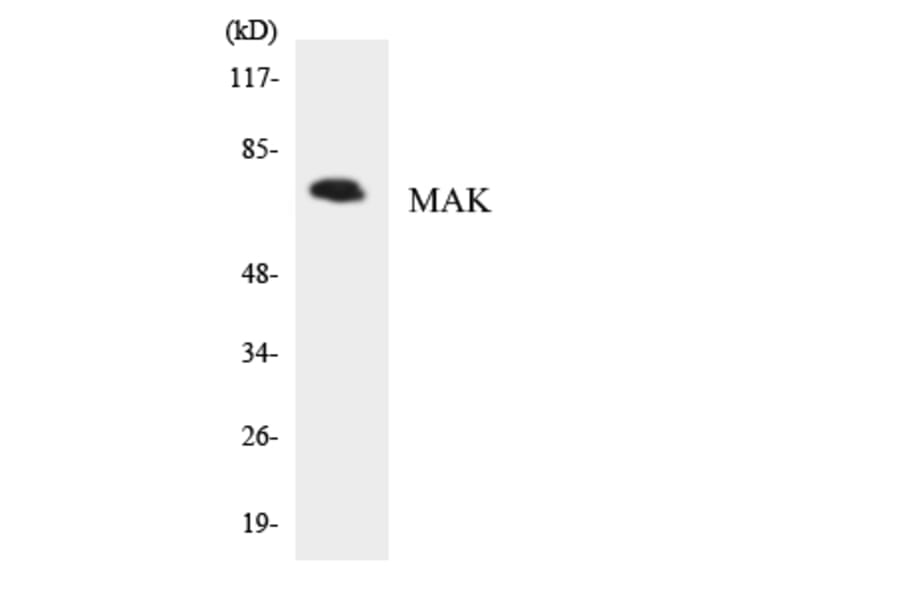 Western Blot - Anti-MAK Antibody (R12-2988) - Antibodies.com