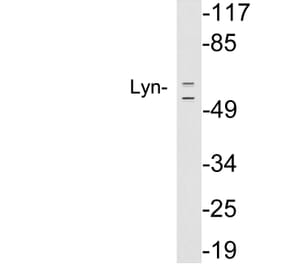 Western Blot - Anti-Lyn Antibody (R12-2229) - Antibodies.com