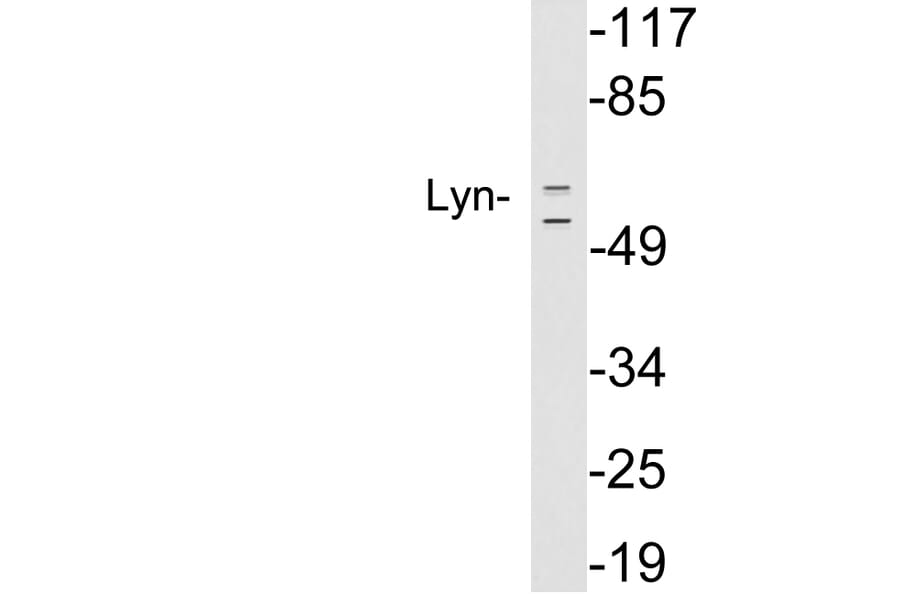 Western Blot - Anti-Lyn Antibody (R12-2229) - Antibodies.com