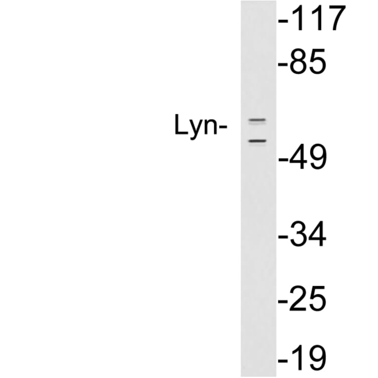 Western Blot - Anti-Lyn Antibody (R12-2229) - Antibodies.com