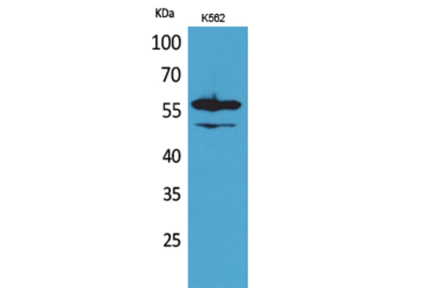 Western Blot - Anti-Lyn Antibody (R12-2229) - Antibodies.com