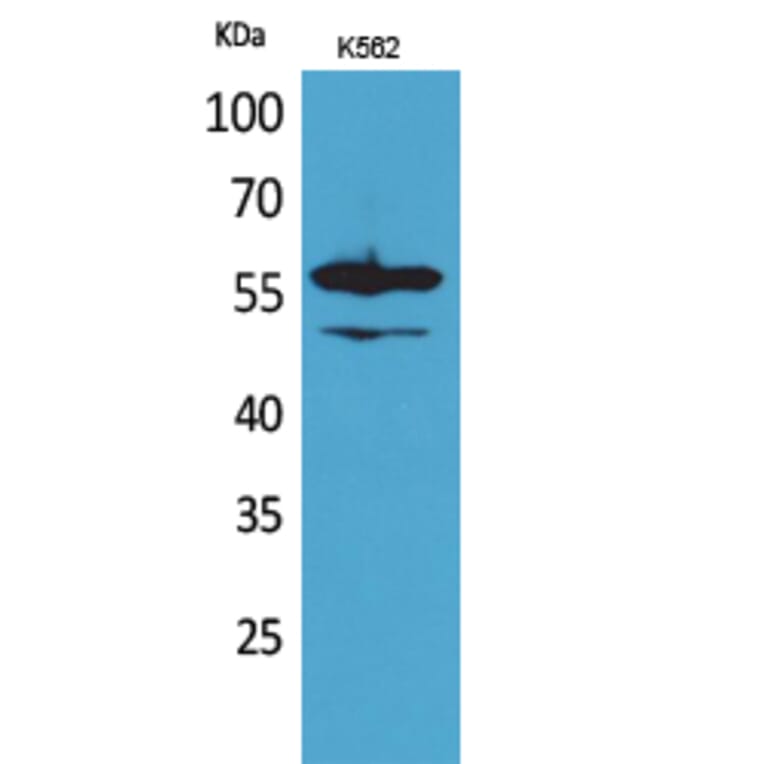 Western Blot - Anti-Lyn Antibody (R12-2229) - Antibodies.com