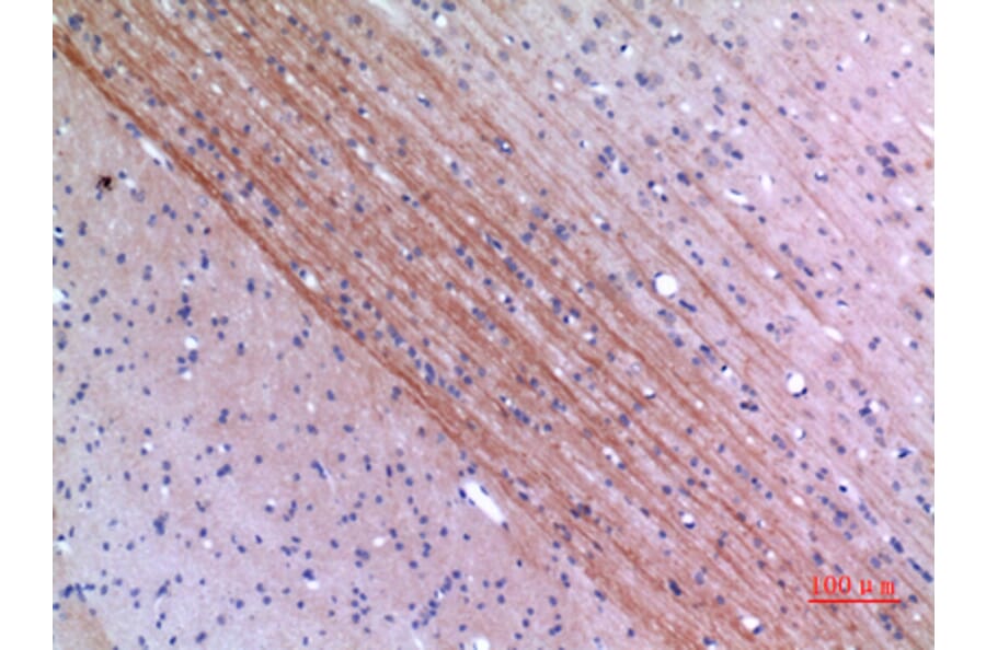 Immunohistochemistry - Anti-Lyn Antibody (R12-2229) - Antibodies.com