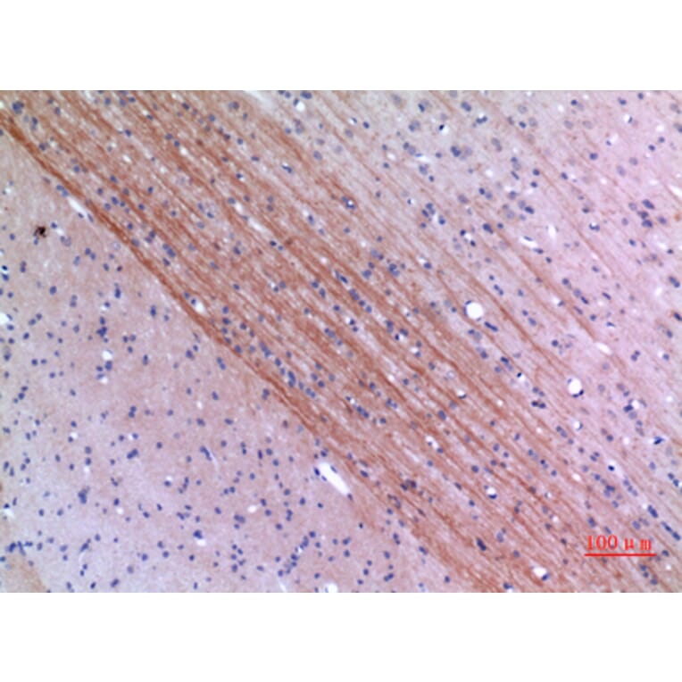 Immunohistochemistry - Anti-Lyn Antibody (R12-2229) - Antibodies.com