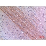 Immunohistochemistry - Anti-Lyn Antibody (R12-2229) - Antibodies.com