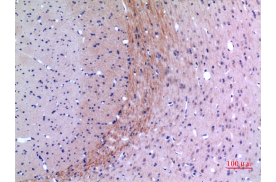 Immunohistochemistry - Anti-Lyn Antibody (R12-2229) - Antibodies.com
