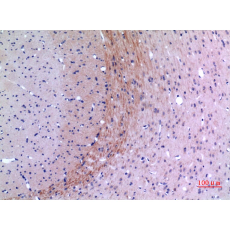 Immunohistochemistry - Anti-Lyn Antibody (R12-2229) - Antibodies.com