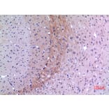 Immunohistochemistry - Anti-Lyn Antibody (R12-2229) - Antibodies.com