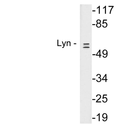 Western Blot - Anti-Lyn Antibody (R12-2230) - Antibodies.com
