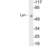 Western Blot - Anti-Lyn Antibody (R12-2230) - Antibodies.com