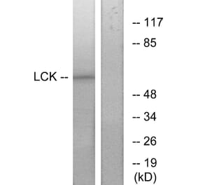 Western Blot - Anti-Lck Antibody (B7139) - Antibodies.com