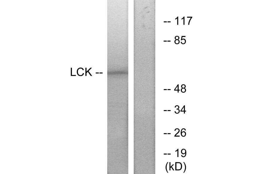 Western Blot - Anti-Lck Antibody (B7139) - Antibodies.com