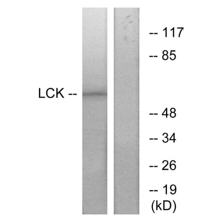 Western Blot - Anti-Lck Antibody (B7139) - Antibodies.com